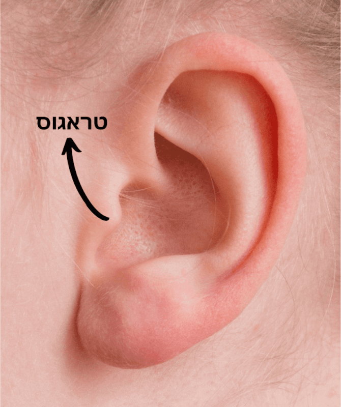 דלקת אוזן חיצונית (דלקת שחיינים)