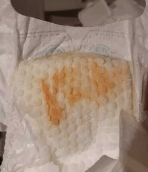אבני אוראט אבני אוראט