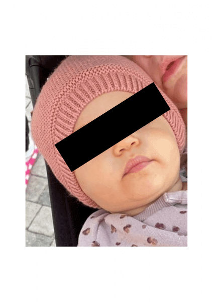 קרוטנמיה – התינוק הכתום