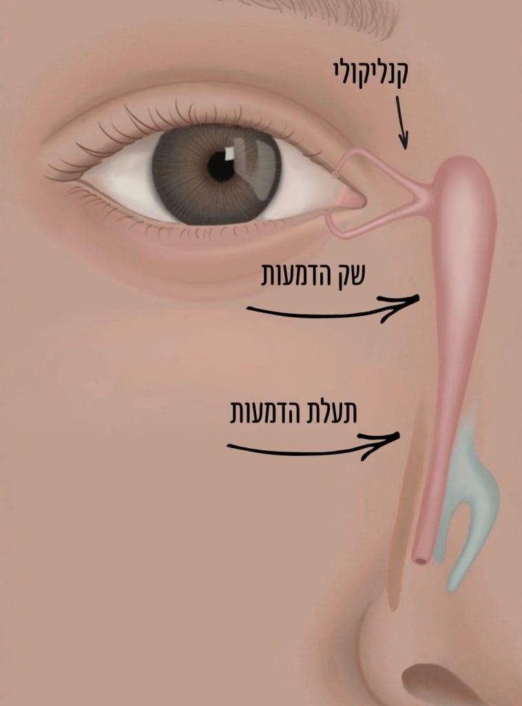 חסימה או היצרות בדרכי הדמעות בתינוקות – מה חשוב לדעת?