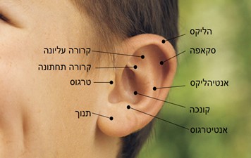 אוזניים בולטות בילדים וניתוח הצמדת אוזניים