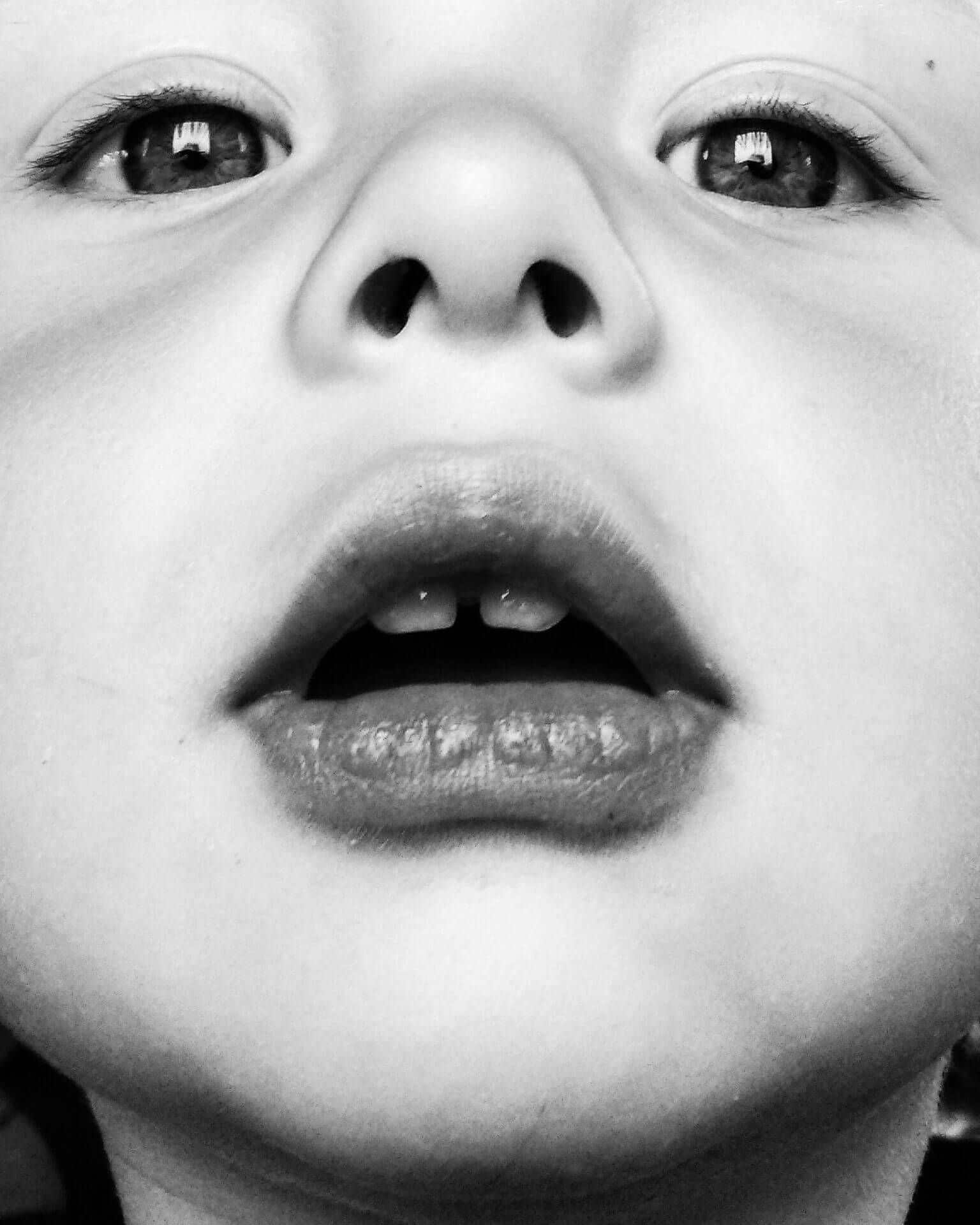 הסוף לוויכוח - האם בקיעת שיניים בילדים מביאה לחום או לסימפטומים אחרים – מאמר מדעי