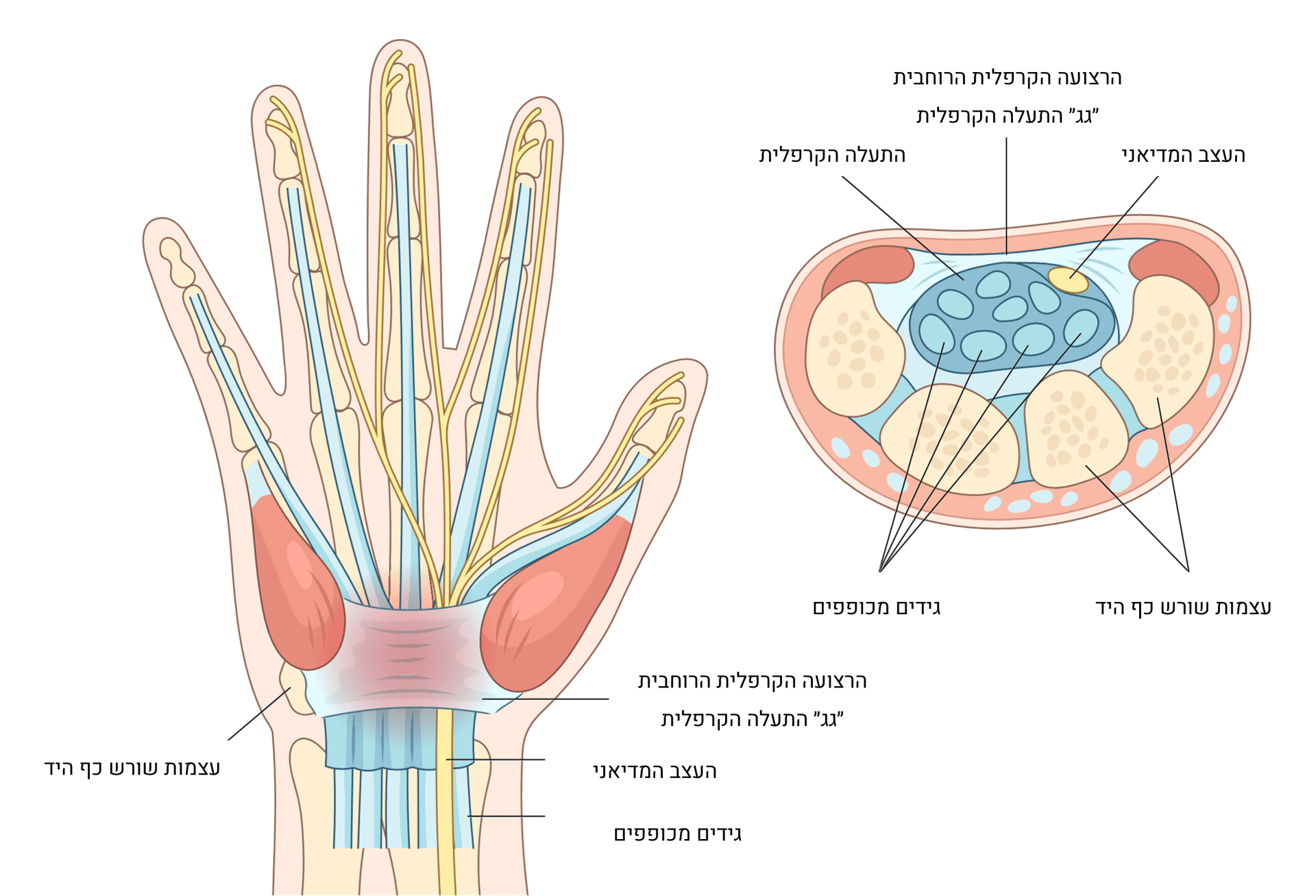 תסמונת התעלה הקרפלית - איך לאבחן ואיך לטפל