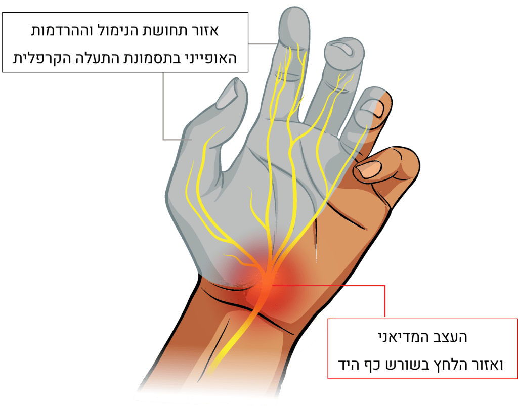 אזור הנימול