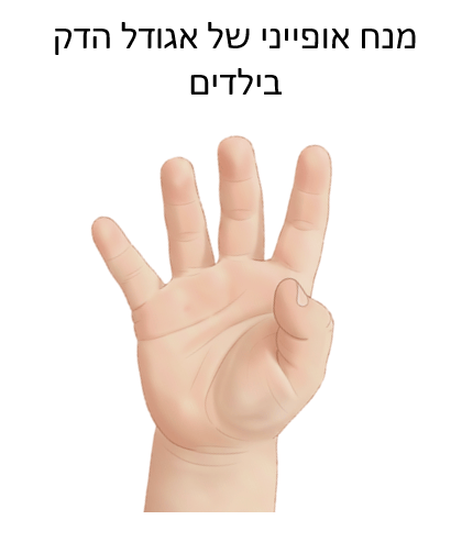 אצבע הדק (Trigger finger) בילדים ומבוגרים